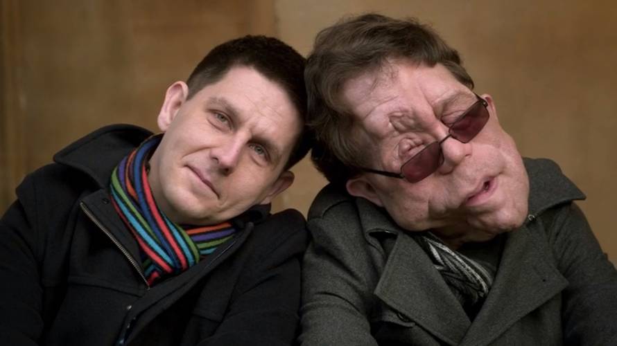 Identical twins who grew up to be different