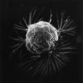 Revolucija u liječenju raka: Stanice tumora lovit će virusi