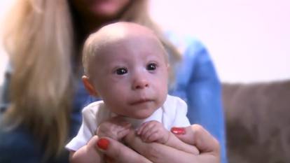 Mali princ: Matthew ima sedam mjeseci i samo 1,6 kilograma