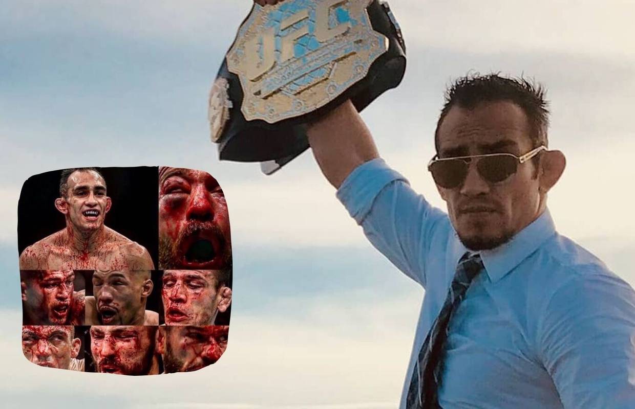 Tony 'krvavo' izazvao Khabiba: Bit će mjesta za 'debelu glavu'