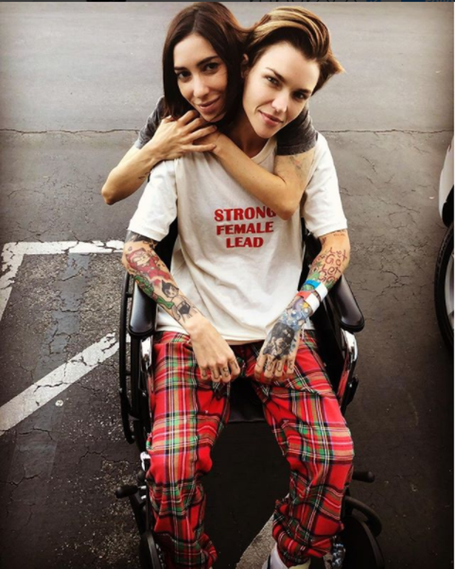 Ruby Rose u kolicima: 'Morala sam na operaciju kralježnice'