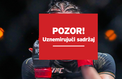 UZNEMIRUJUĆE Šok i horor za Meksikanku: Ovo je najgora posjekotina u povijesti UFC-a