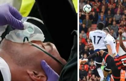 Igrač Evertona doživio frakturu lubanje nakon sudara glavama
