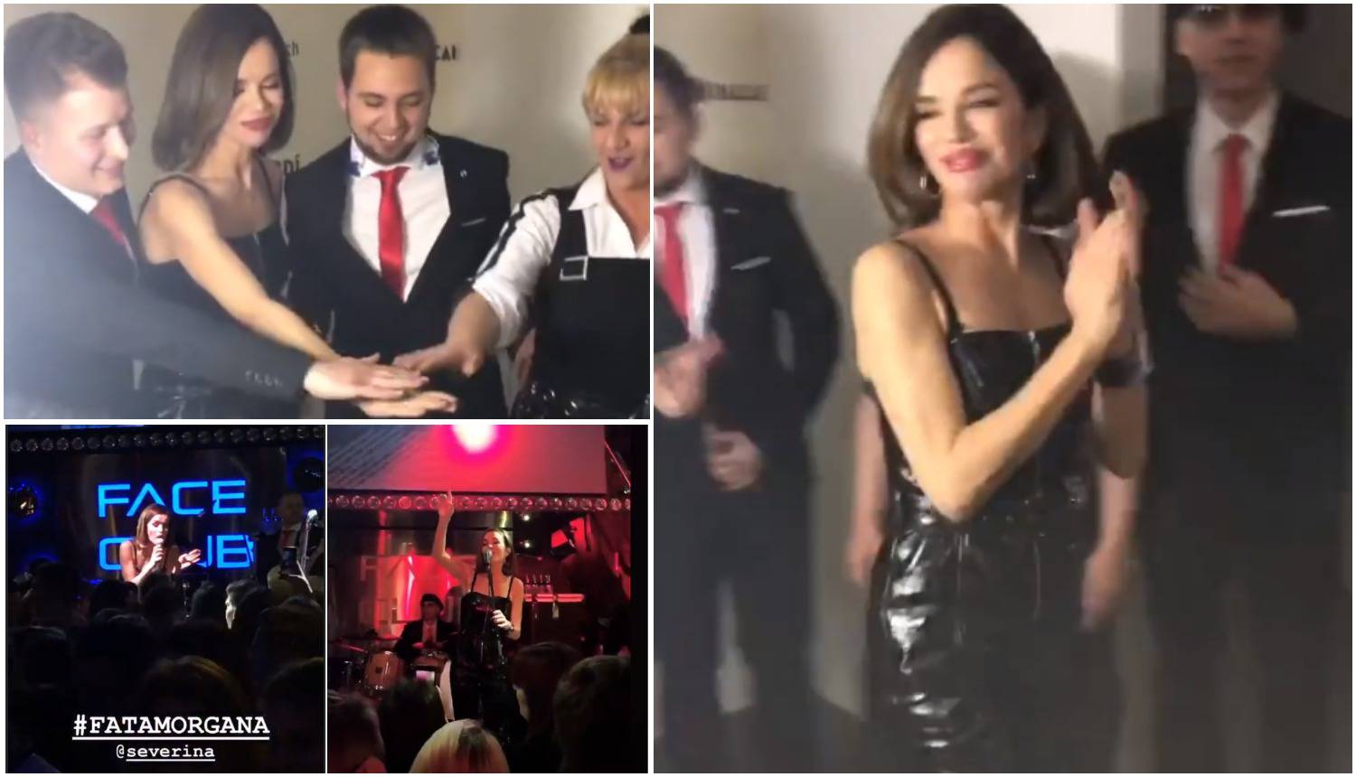 Severina u bolnici: Zabrinula je fanove  pa obrisala fotografiju