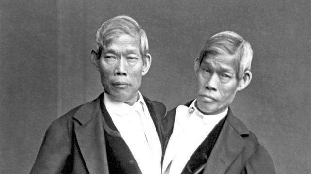 Thailand / USA: Chang and Eng Bunker, the original conjoined 'Siamese Twins', in their later years, North Carolina, 1865