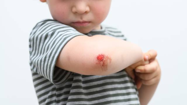 Boy,Kid,Arm,Accident,Wound,He,Painful,Abrasion,Scratches,From