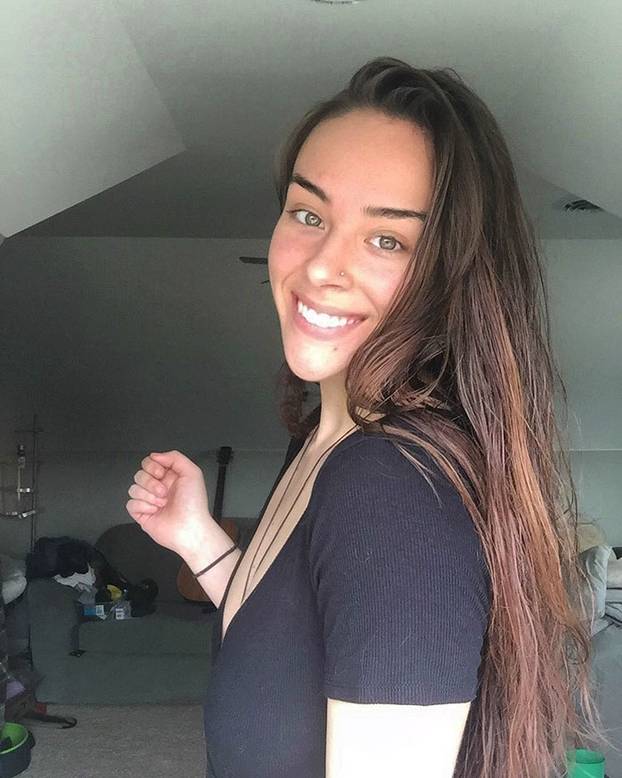 FOTO Prestala je 2016. brijati dlake na tijelu. Ovo je rezultat