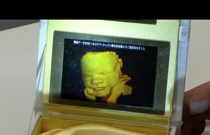 Uskoro ćemo s ultrazvuka nositi i 3D holograme beba