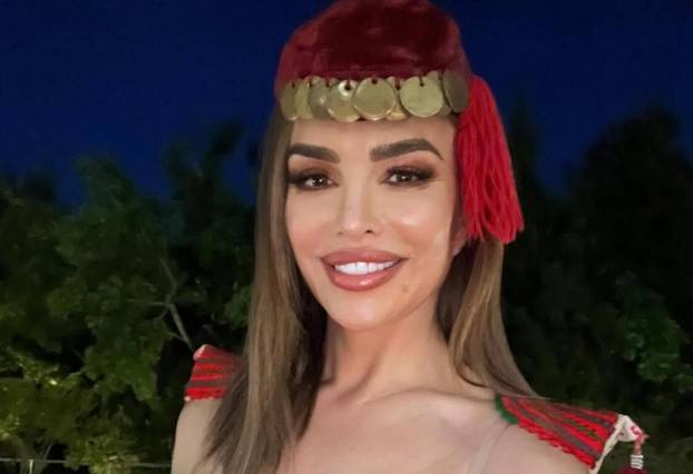 Šuput i ostale zvijezde: Kako izgledaju bez filtera i nakon 'peglanja'. Pogledajte fotke!