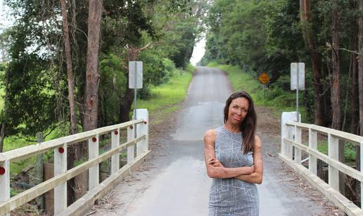 Turia Pitt i dalje inspirira ljude širom svijeta: Požar joj je uništio lice, ali ne i duh