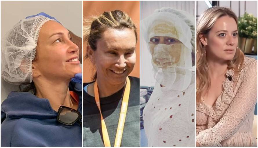 Svi na krvnu plazmu: 'Vampirski face lifting' zaludio je Hrvatice!