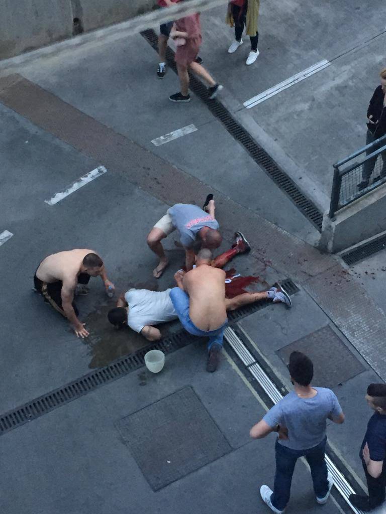 Jezivi prizori iz Splita: Krvav zapomagao nakon pucnjave...