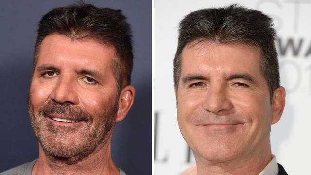 Simon Cowell ponovo šokirao gledatelje, obrazi puniji, a koža zaglađenija: 'Što mu je s licem?'