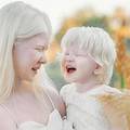 Predivne albino sestre osvajaju svijet, izgledaju kao dva anđela