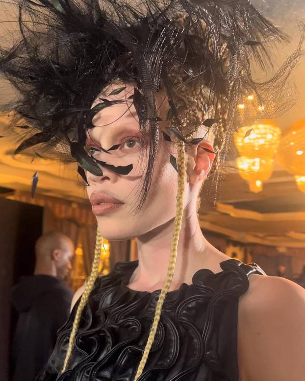 FOTO Afrikanka s albinizmom osvaja modnu industriju: 'Često privlačim znatiželjne poglede'