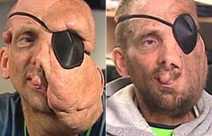 Poklonili mu operaciju da si nakon 30 godina vidi lice