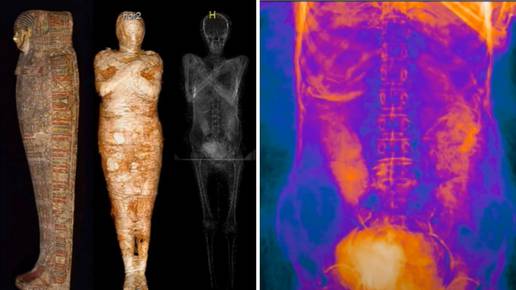 Poljski znanstvenici otkrili prvu trudnu mumiju na svijetu