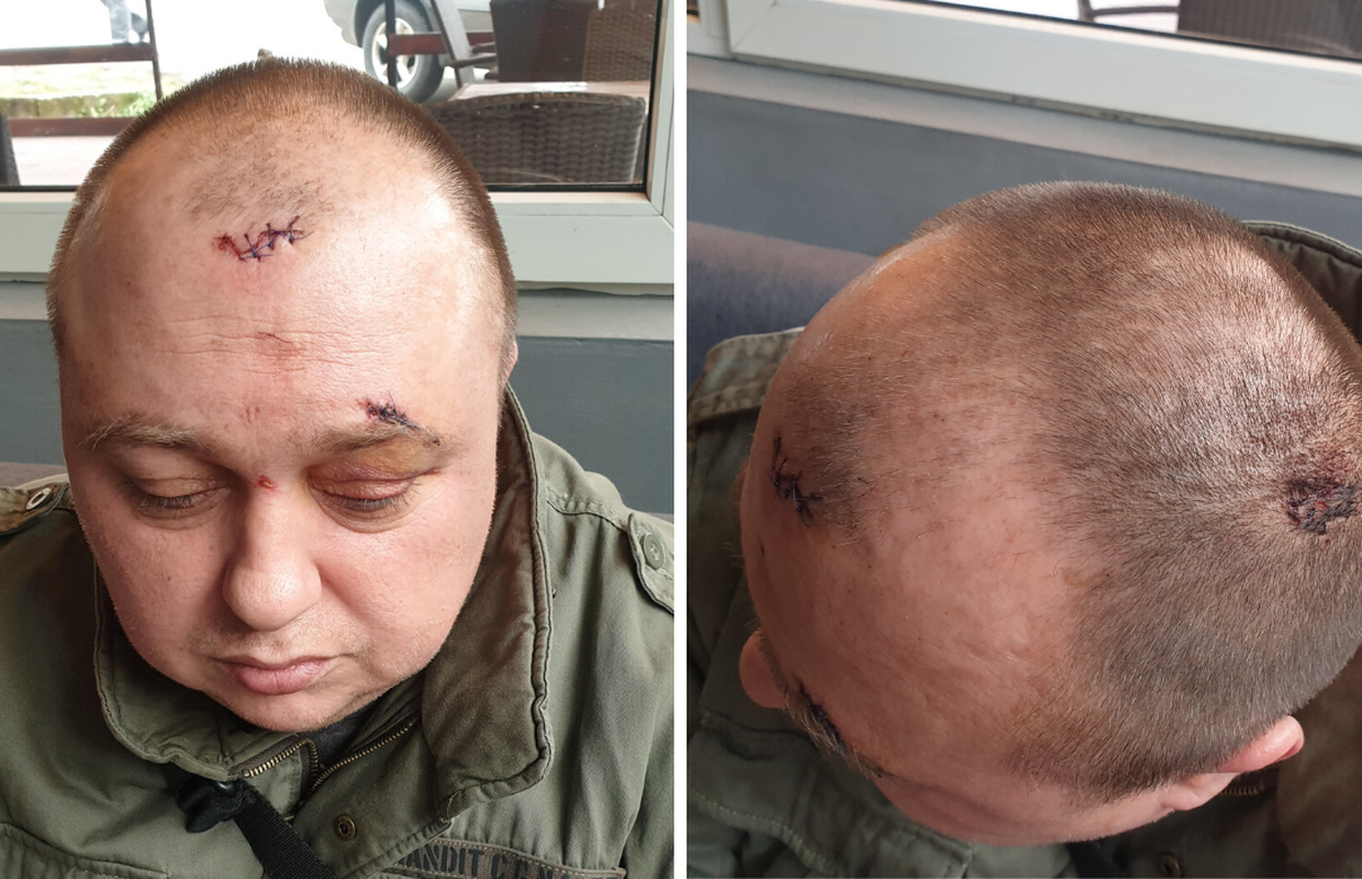 'Prvi me tukao šakama, a drugi me pepeljarom udarao po glavi'
