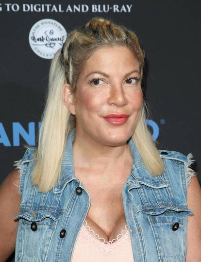 FOTO Tori Spelling prvi put išla 'pod nož' sa 16 godina: Kroz karijeru često šokirala izgledom