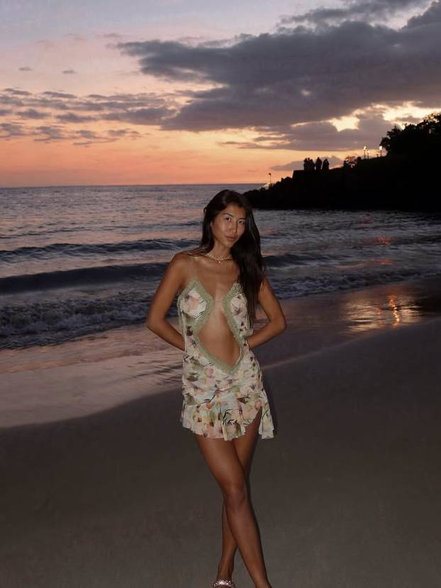 FOTO Mlada manekenka svoju 'nesigurnost' pretvorila u posao iz snova: 'To mi je najveći adut'