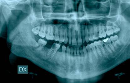 Koji zub vas boli? To otkriva problem s određenim organom