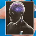 Parkinsonova bolest: Pomaže dubinska stimulacija mozga