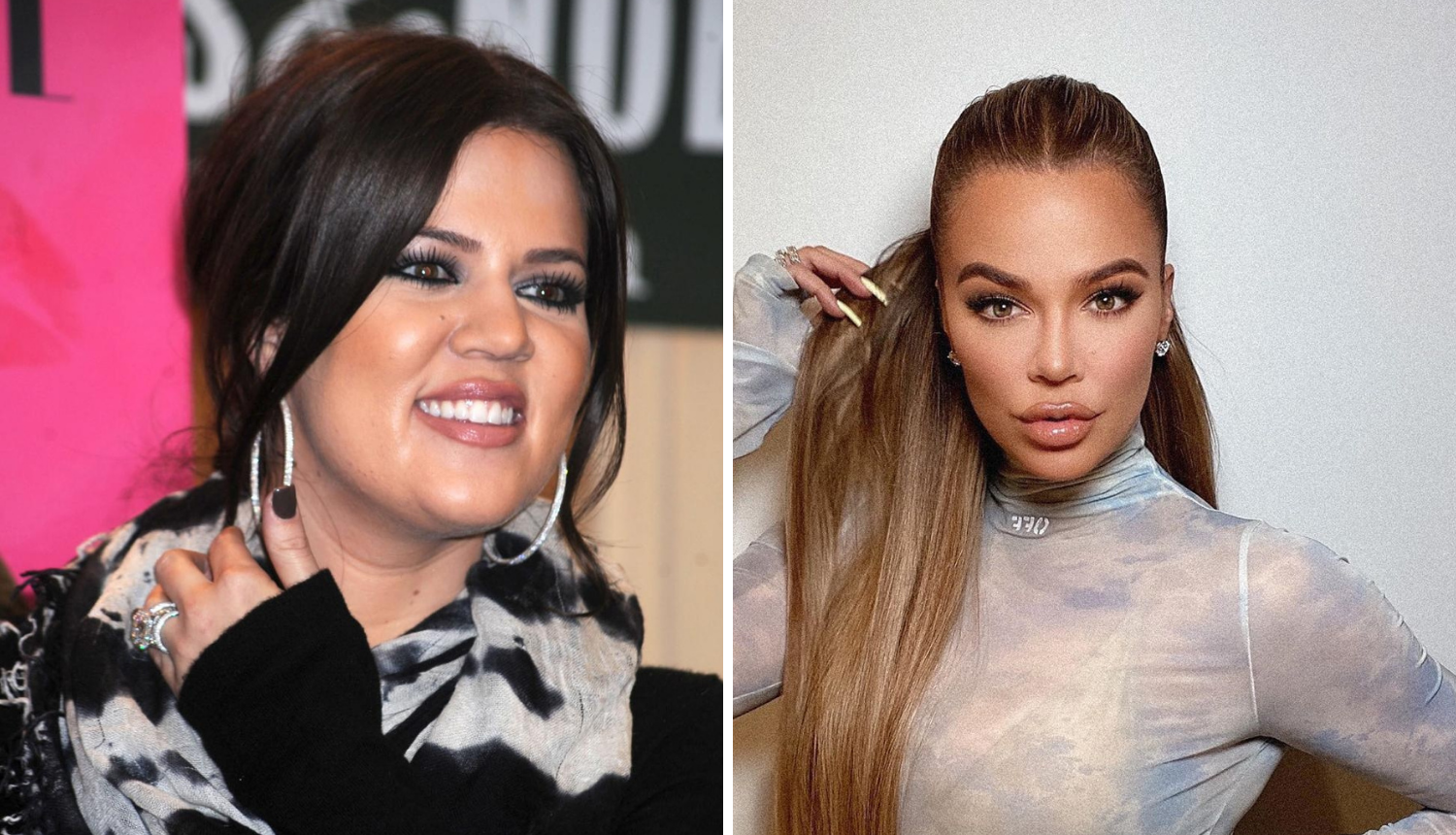 Khloe Kardashian progovorila o estetskim zahvatima: 'Botoks ne volim, a operirala sam nos'