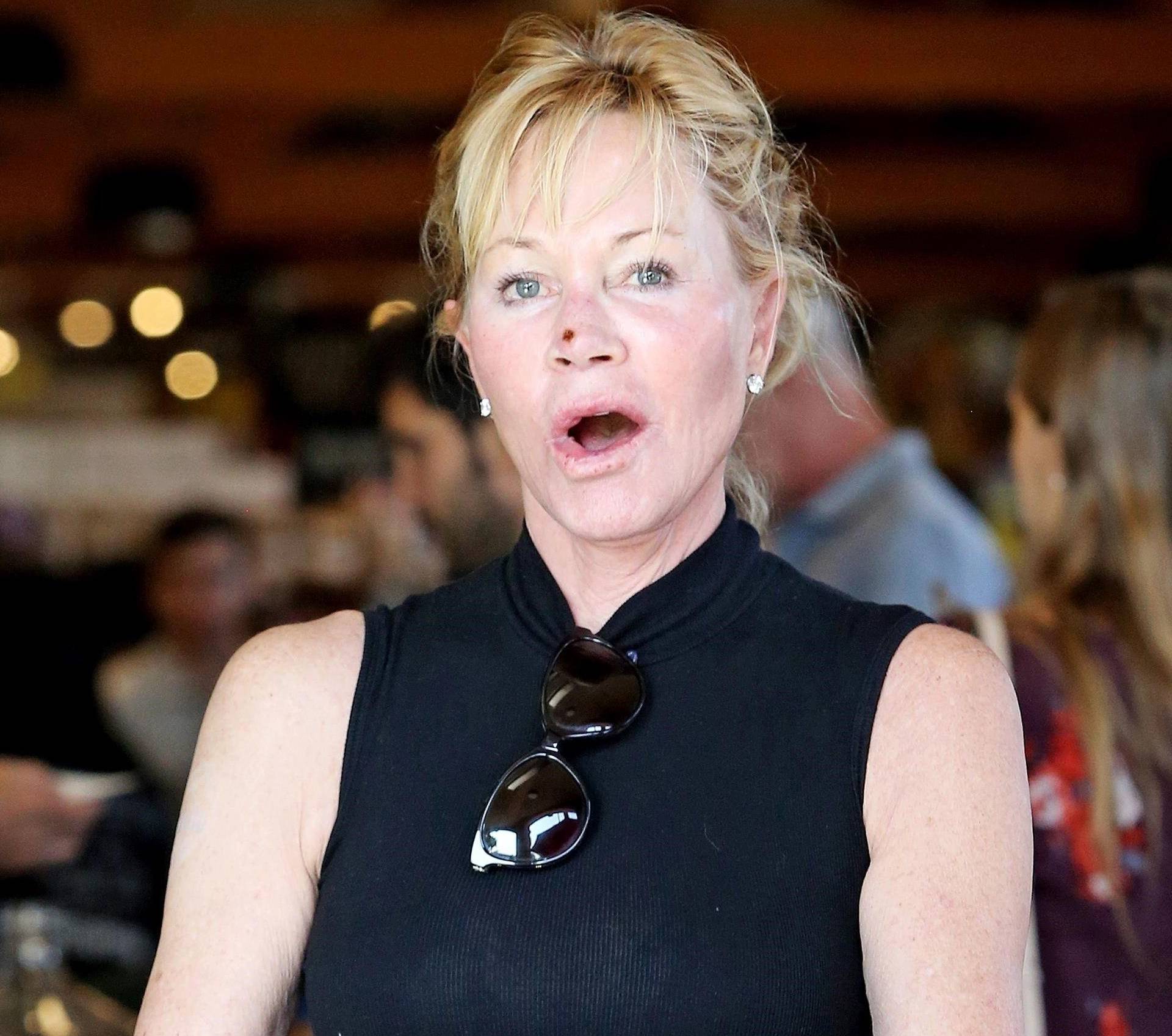 *EXCLUSIVE* Makeup free Melanie Griffith steps out with a scab on her face