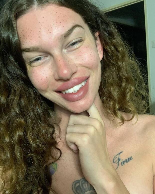 FOTO Htjela je biti žena mačka, a sad plače: Dala sam 7000 €, a fileri su me unakazili! Pomiču se