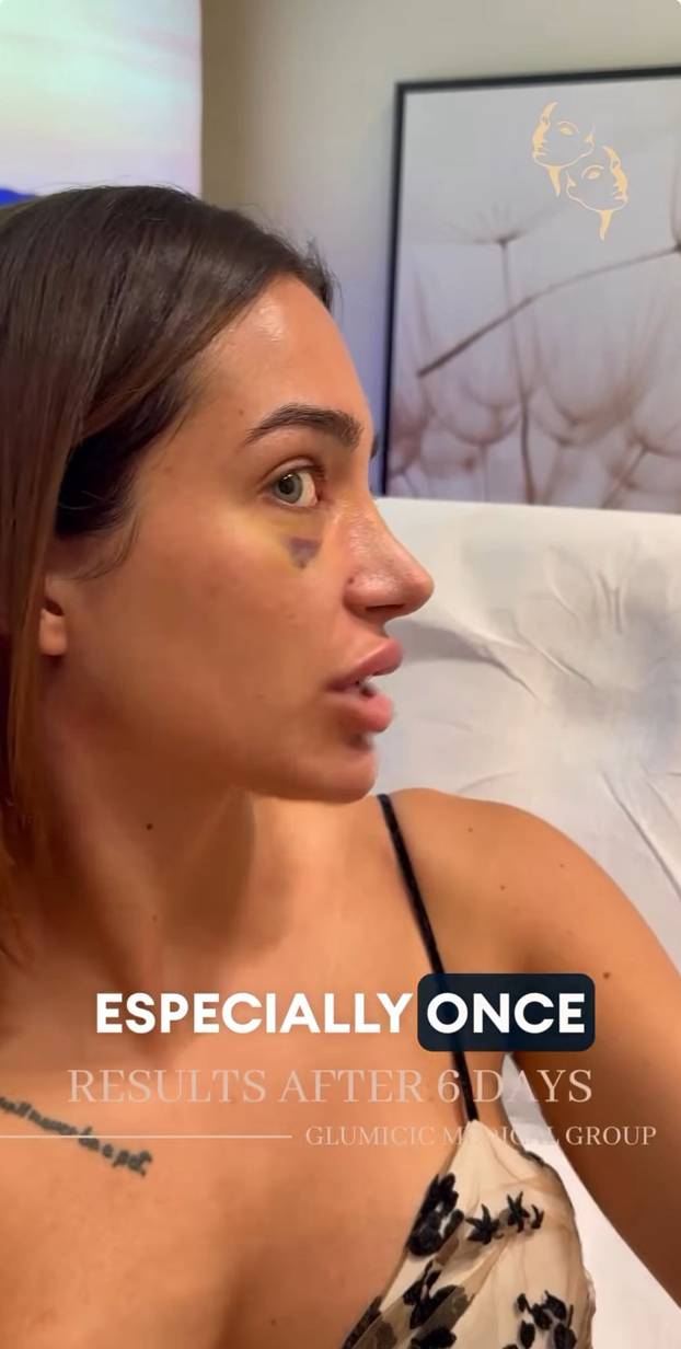 FOTO 'Savršena' Laura donijela novu odluku: 'Vraćaju se fileri'