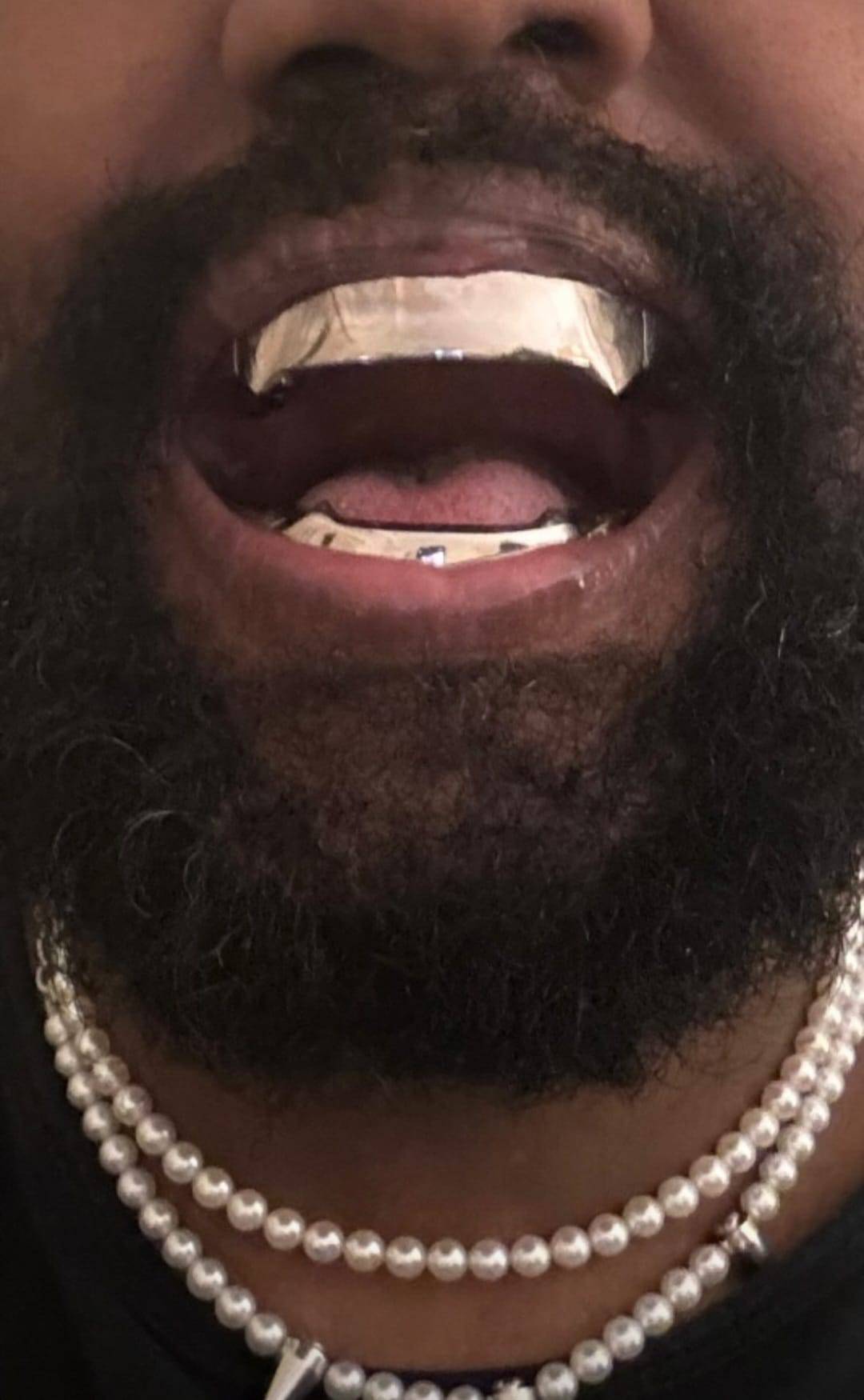 Kanye West uklonio zube te ih zamijenio protezom od titana