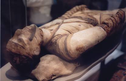 I u starom Egiptu prije 3500 godina bilo je ateroskleroze