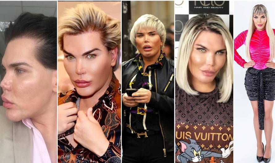 Bio je Ken pa Barbie: Ovisnik o nožu pokazao kako je izgledao