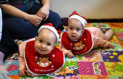 Prvi Božić sijamskih blizanki: 'Presretni smo, a one su super'