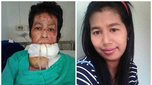 Ljubomorni muž zapalio ženu zbog fotografija na Facebooku