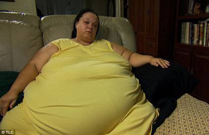 Ženi od 275 kg kirurg smanjio želudac, sada je veličine jajeta