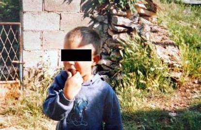 Zadar: Dječak je petardom raznio ruku i ozlijedio oko