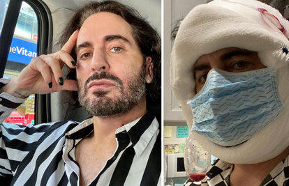 Dizajner Marc Jacobs podvrgnuo se faceliftingu, operaciju platio 315 tisuća kuna: 'Sretan sam'