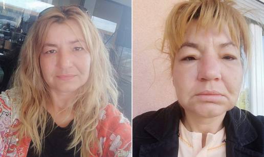 Mihaela živi s rijetkom bolesti: Otičem kao da su me izbole ose