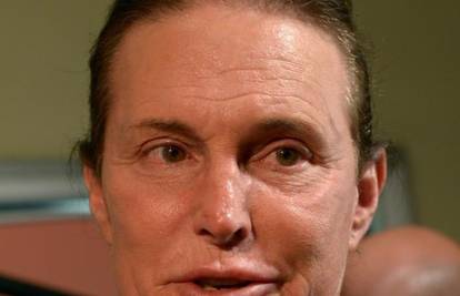 Bruce Jenner podvrgnuo se operaciji spola i postao žena?