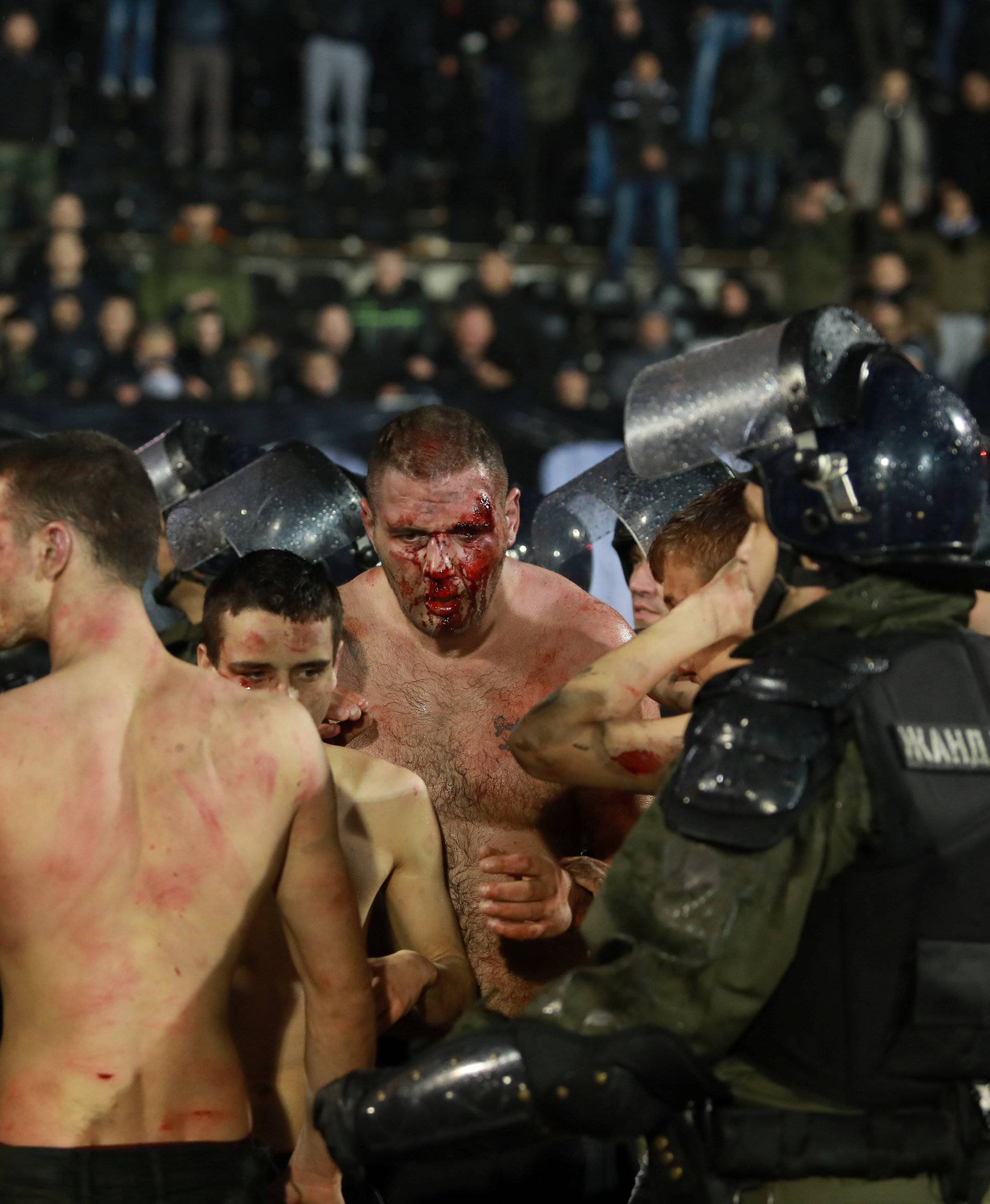 Police escort the soccer fans injured during the fights at a match between Red Star and Partizan in Belgrade