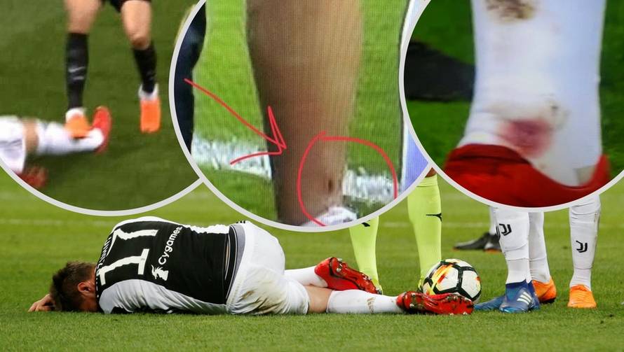 Čudesni Juve okrenuo je Inter! Mandžo je igrao s rupom u nozi