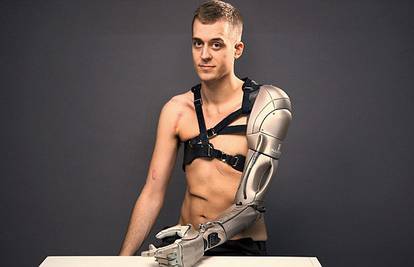 Polukiborg: Lijeva ruka mu je bionička, a ima punjač i dron