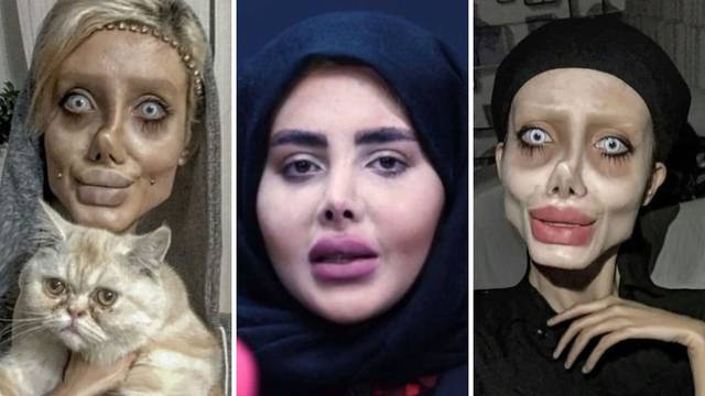 Gdje je nestala iranska 'zombi Angelina Jolie'?: Od izlaska iz zatvora gubi joj se svaki trag...