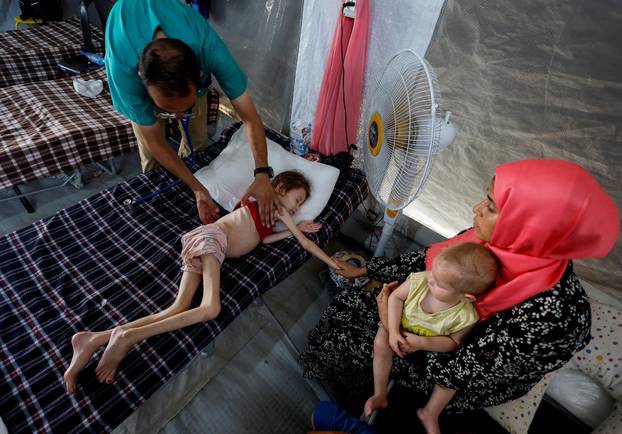 FILE PHOTO: Malnourished Palestinian children receive treatment at the IMC field hospital in Deir Al-Balah, central Gaza Strip