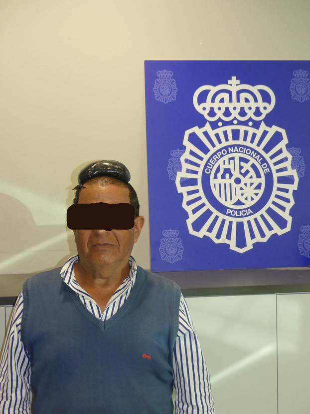 A man poses with a drug package on his head, that he hid under a toupee, after being arrested in Barcelona