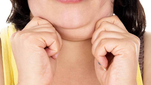 Jednostavne vježbe lica mogu vam pomoći smanjiti podbradak