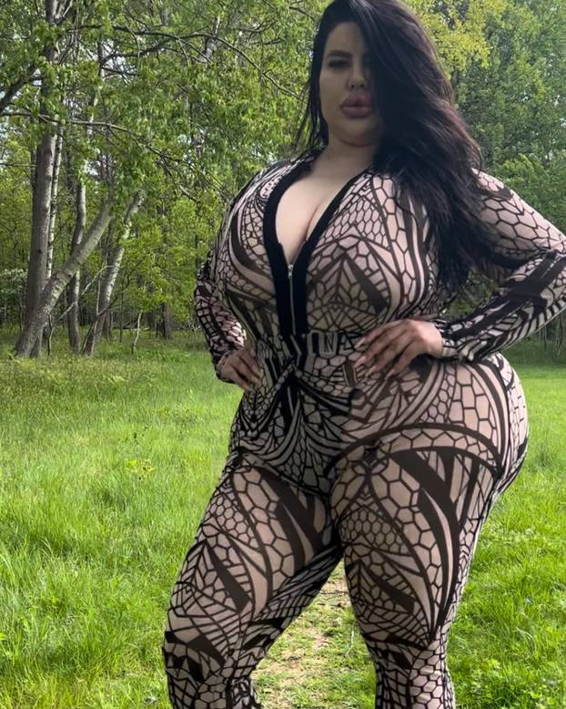 FOTO Stražnjica mi teži 45 kila, no već imam u planu sljedeću operaciju, želim imati najveću!