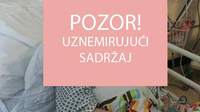 Osjetila je mučninu, pojavio se osip, a sada će ostati bez nogu