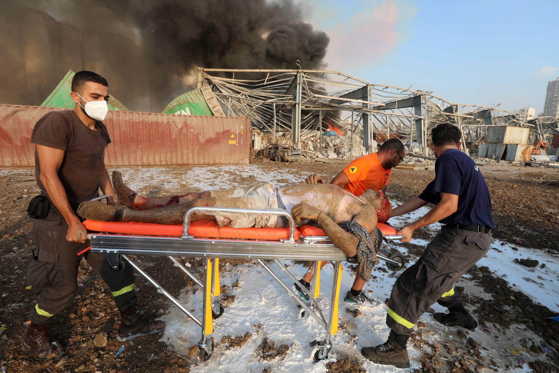 An injured man is transported on a stretcher following an explosion in Beirut's port area